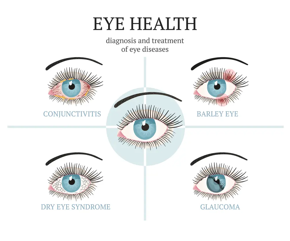 目の病気とNMNの効果加齢性黄斑変性症